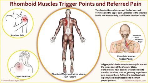 Rhomboid Major And Rhomboid Minor Muscles Trigger Point Pain The