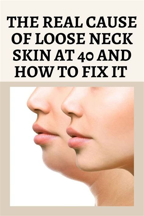 The Real Cause Of Loose Neck Skin At 40 And How To Fix It Loose Neck