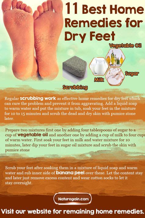 10 Best Dry Feet Remedies Images In 2020 Remedies Dry Feet Remedies