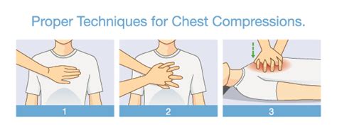 How To Perform High Quality Chest Compressions Cpr First Aid For Free