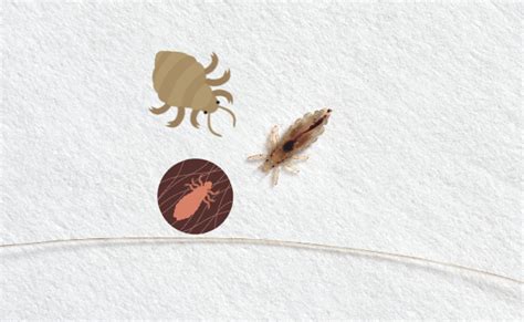 Pubic Lice Crabs Infestation Symptoms And Treatment