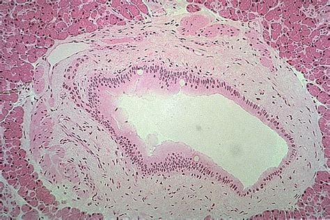Pancreas Color Images