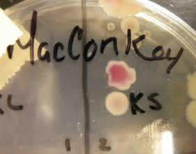 Macconkeys Agar Microbiology Images Science Photographs
