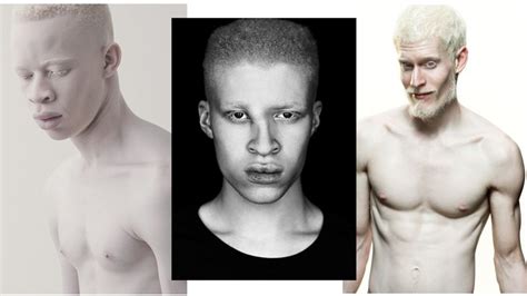 Three Albino Models Who Are Conquering The Fashion World Vogue France