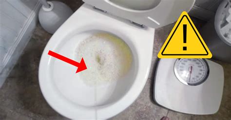 Urina Com Espuma Descubra O Que Pode Ser