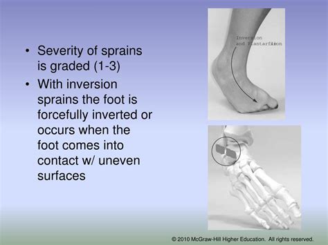 Ppt Chapter 15 The Ankle And Lower Leg Powerpoint Presentation Free