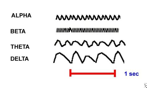 Normal EEG Waveforms: Overview, Frequency, Morphology ...