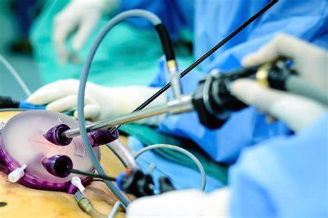 Лапароскопия желчного пузыря диета после Лапароскопия желчного пузыря цена в Москве, сколько стоимость операции Лапароскопия желчного пузыря цена в Москве, сколько стоимость операции Лапароскопия желчного пузыря диета после