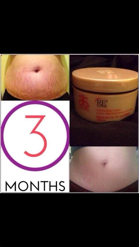 Want To Get Rid Of Those Stretch Marks Or Cellulite Musely