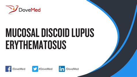 Mucosal Discoid Lupus Erythematosus