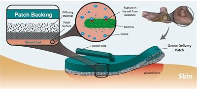 Frontiers Wearable And Flexible Ozone Generating System For Treatment