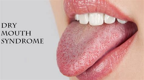The Most Common Mouth Diseases Speaky Magazine