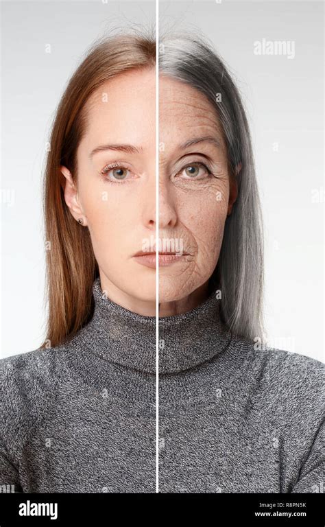 Comparison Portrait Of Beautiful Woman With Problem And Clean Skin
