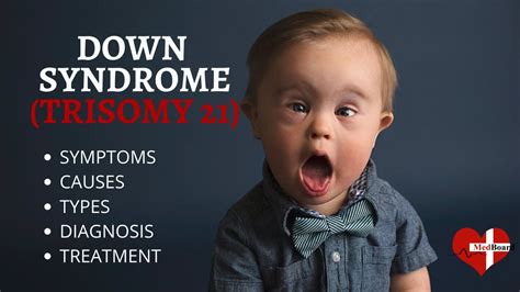What Is Down Syndrome Trisomy 21 Down Syndrome Trisomy 21 Made Easy Youtube