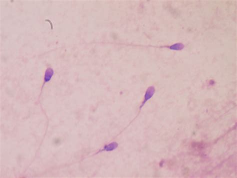 Scientists Created Sperm From Human Skin Cells