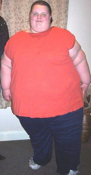Britains Fattest Teenager Georgia Davis Loses 14st In Hospital Daily