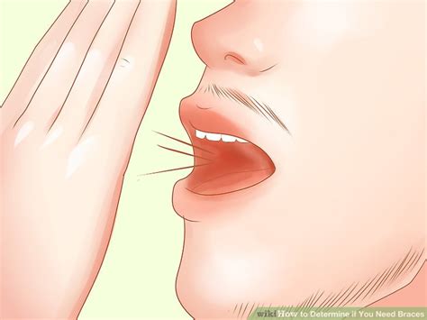 Food particles can get caught in your braces. How to Determine if You Need Braces (with Pictures) - wikiHow