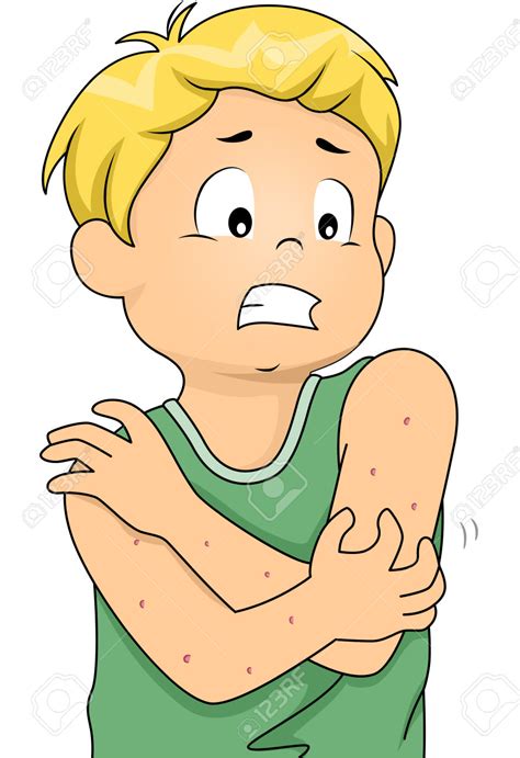Allergic Reaction Clipart Clipground