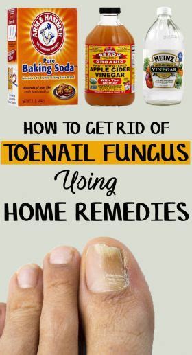 Home Remedies For Toenail Fungus Toenail Fungus Home Remedies
