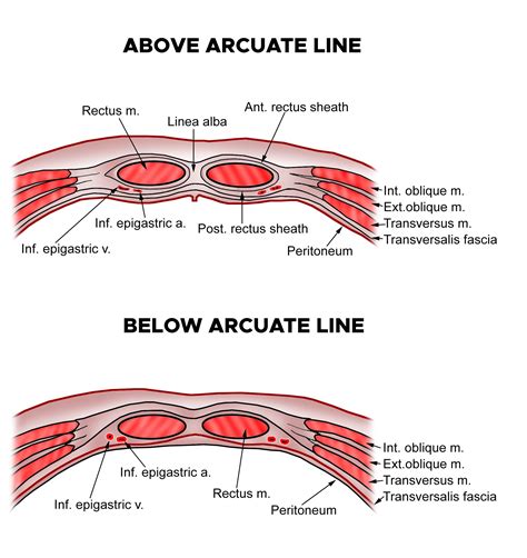 Abdominal Incisions And Anatomy Of The Abdominal Wall Endogynecology