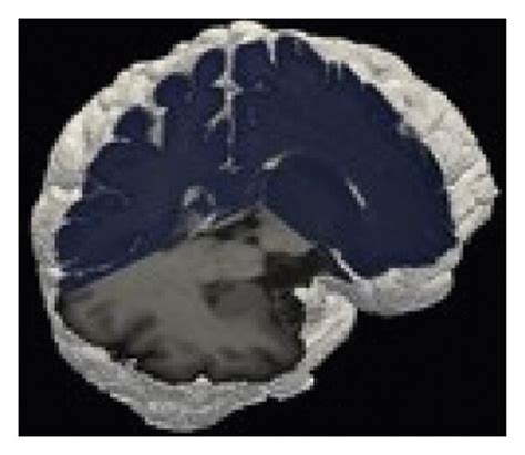 Comparison Of The Reconstructed Three Dimensional Histology With The