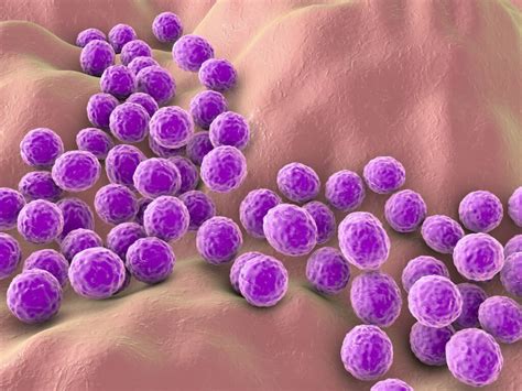 Staphylococcus Aureus Causas Síntomas Y Tratamiento Remedios Caseros