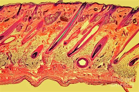 Skin Photograph By Dr Keith Wheelerscience Photo Library Fine Art