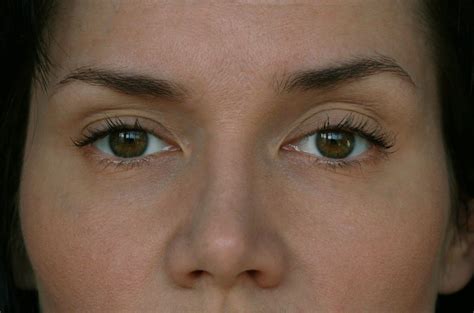 Apr 12, 2019 · your lid should be slightly pulling where your index finger is lying, but there should be no real pain or harsh tugging. How to Lift Eyelids & Excess Eyelid Skin in 2021 | Eye ...