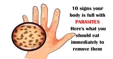 10 Signs Your Body Is Full With Parasites Heres What You Should Eat