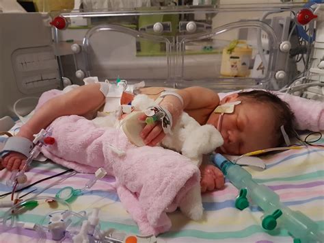 Crowdfunding To Help Swanseas Poorly Babies At Singleton Neonatal