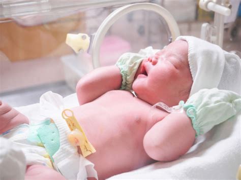 Tips Merawat Bayi Prematur Medcomid