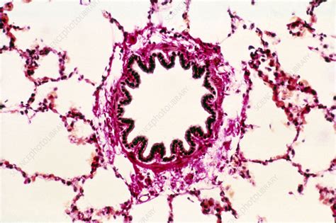 Lm Of A Cross Section Through A Bronchiole In Lung Stock Image P590