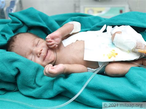 Premature Baby Boy Is Struggling In Nicu To Survive Only You Can Help