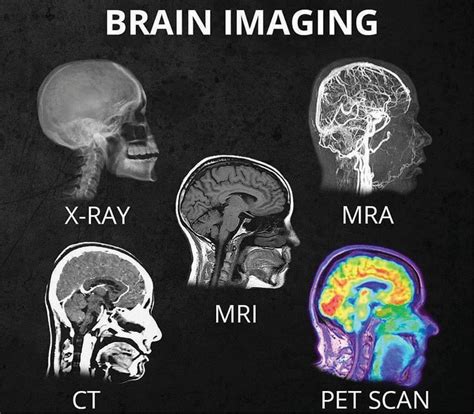 What S The Difference Between All The Different Head Scans X Ray CT