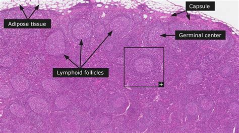 All About Lymph Node Follicles Lymph Nodes Medical School Studying