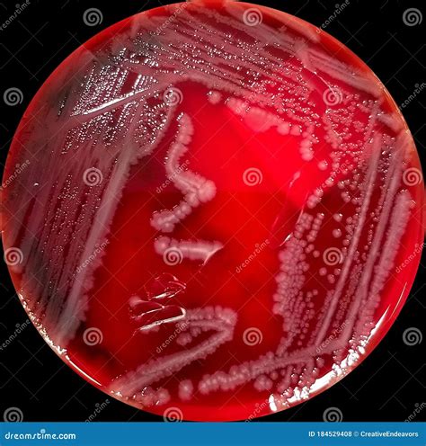 Salmonella On Blood Agar Morphology Culture Characteristics Of