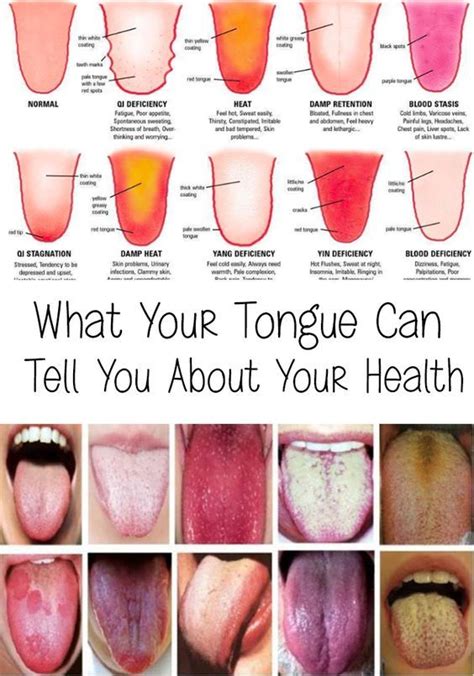 What Your Tongue Can Tell You About Your Health Healthy Tongue Tongue Health Health Tips