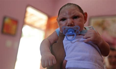 Us scientists have urged the world health organisation to take urgent action over the zika virus, which. Research claims 'proof' of link between Zika virus and ...