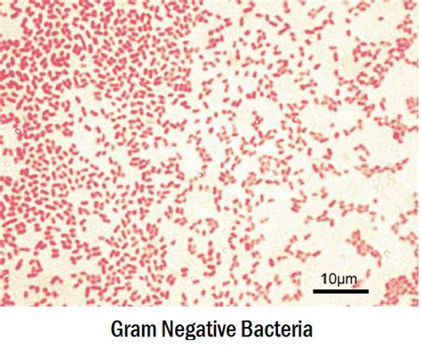 It paves way to the differentiation of the two distinct bacterial species. Differences Between Gram Positive and Gram Negative ...