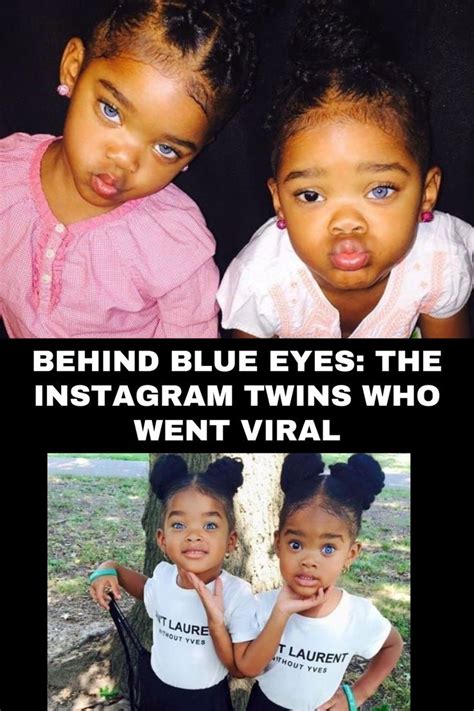 Behind Blue Eyes The Instagram Twins Who Went Viral Artofit