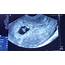 8 Weeks Pregnant No Heartbeat > MISHKANETCOM