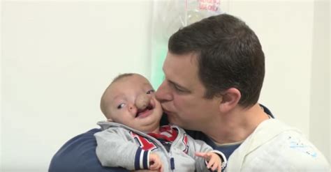 This Baby Was Born With A Lump Under His Nose When You Find Out Why