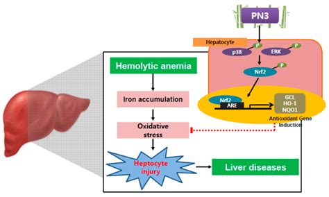 Hemolytic Anemia Liver Disease Captions Todays