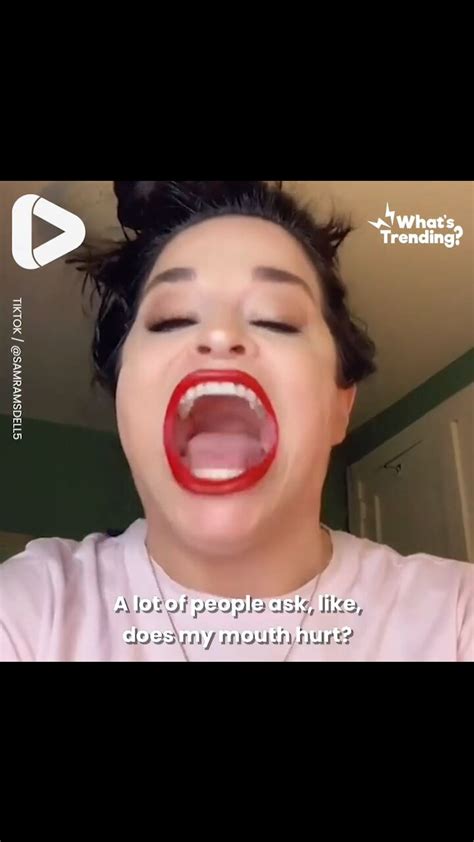 Woman Has Biggest Mouth In The World