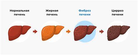 Диеты при увеличении печени