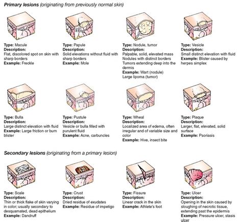 Types Of Skin Lesions Top 10 Most Aggressive Types Of Cancer Skin