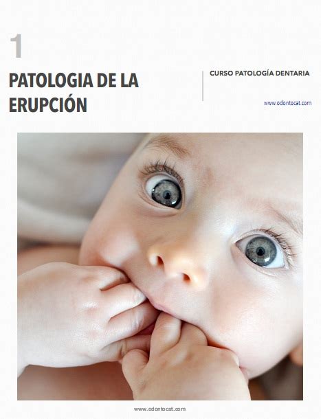 Odontocat Curso Online De Patología Dentaria