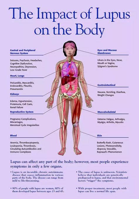 What Is Lupus Lupus Diet Lupus Facts Lupus Awareness