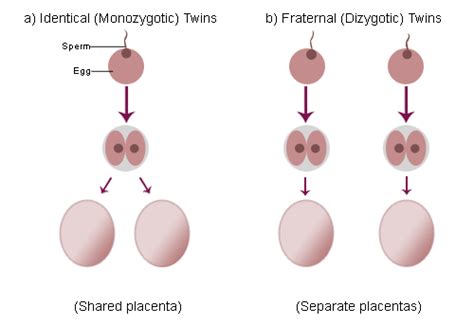 difference between identical and fraternal twins compare the difference between similar terms