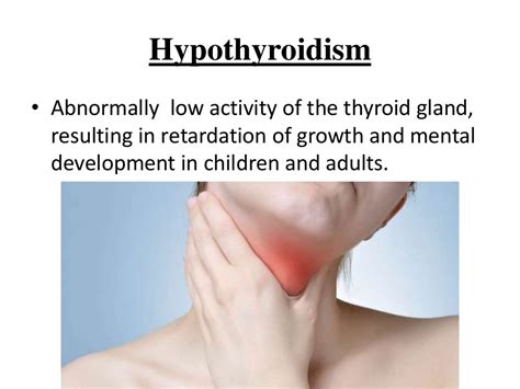 Hyperthyroidism And Hypothyrodism